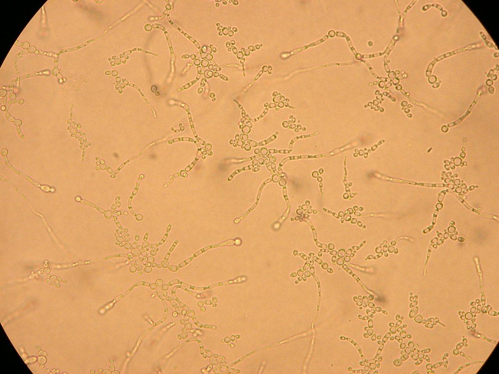 candida albicans microscopic appearance