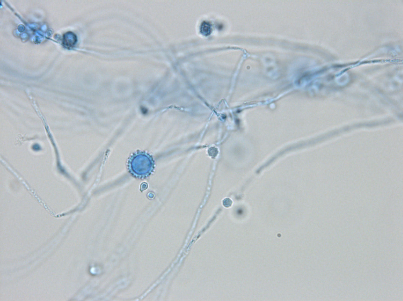 Dimorphic fungi - Life Worldwide