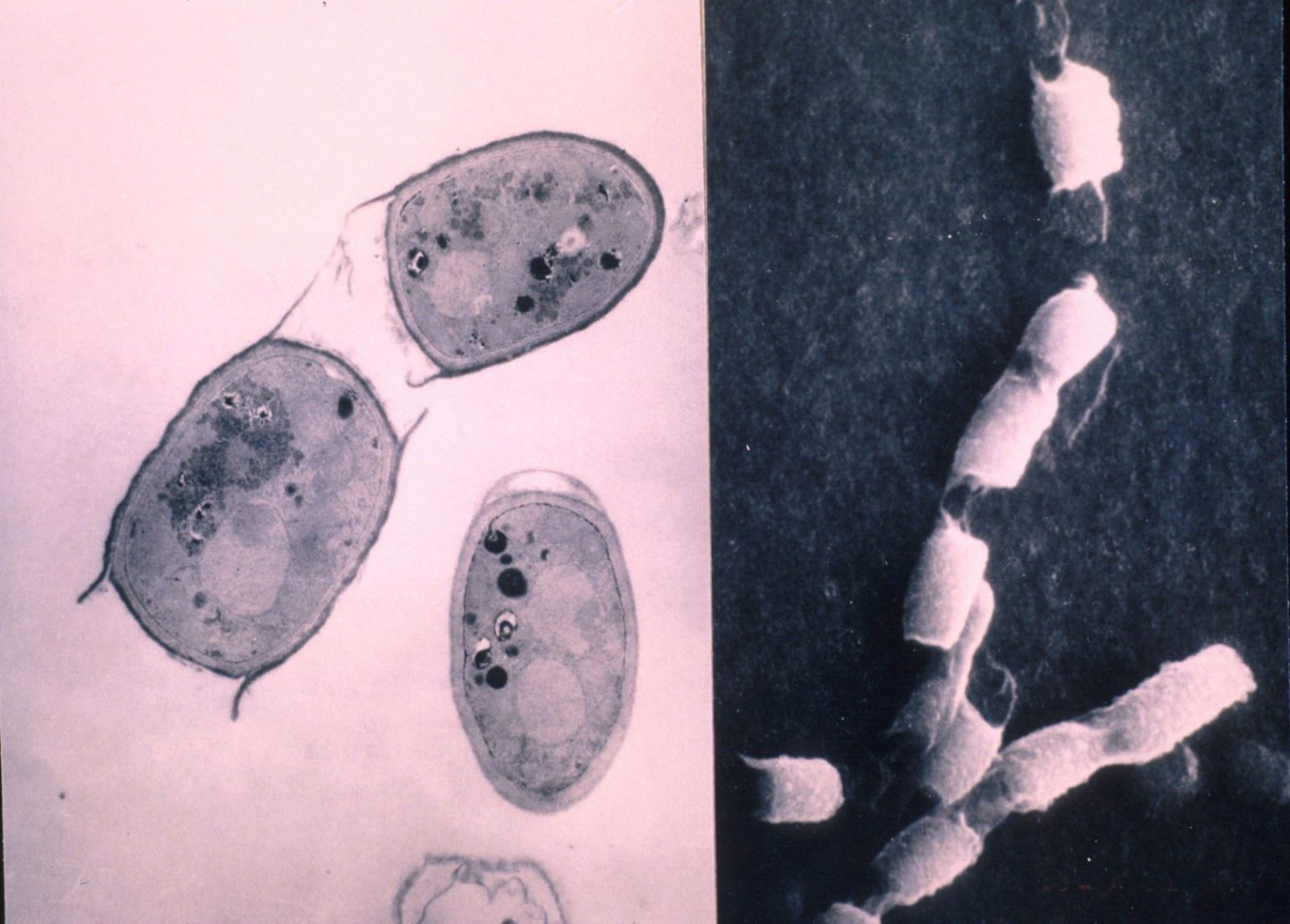 Dimorphic fungi - Life Worldwide