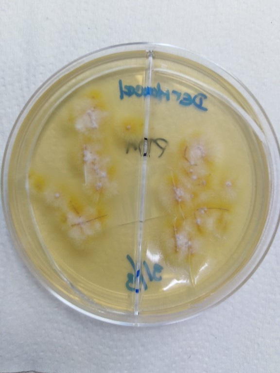 Macroscopic morphology of Microsporum canis. Four-days colonies from tinea capitis.