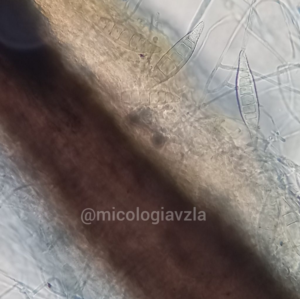 Microscopic morphology of Microsporum canis 