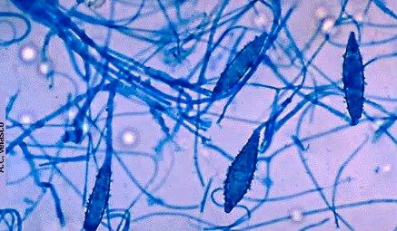 Lactophenol cotton blue microscopy of the colony grown in vitro