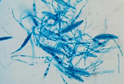 Lactophenol cotton blue microscopy of the colony grown in vitro